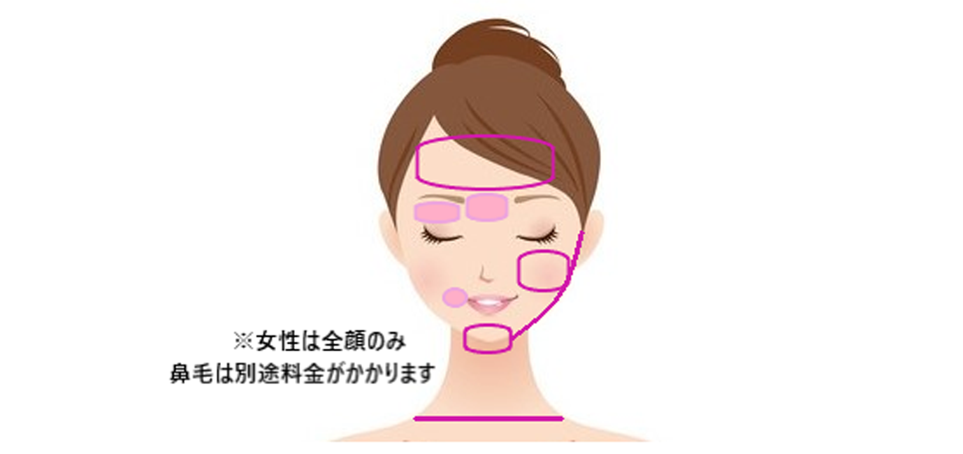 名古屋で医療脱毛なら名駅すぐの名古屋駅健診クリニック美容皮膚科｜医療脱毛